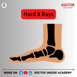 hard x rays