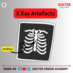 x ray attifacts