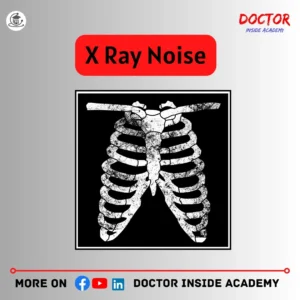 x ray noise 