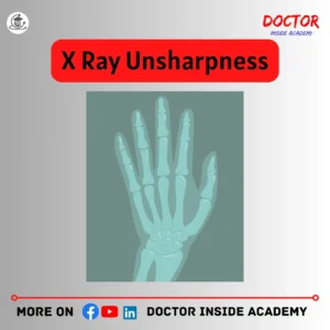 x ray image unsharpness