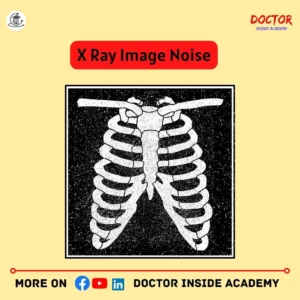 X ray Image Noise